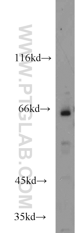 Western Blot (WB) analysis of Jurkat cells using HSF5 Polyclonal antibody (17765-1-AP)