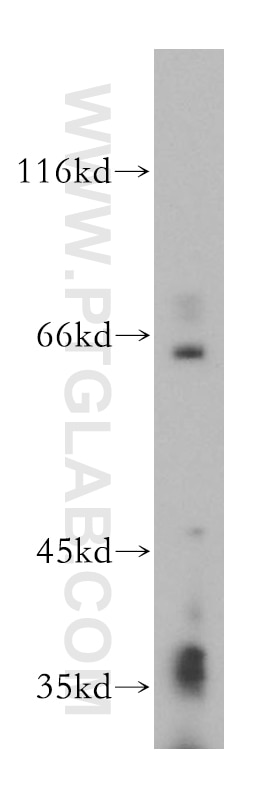 Western Blot (WB) analysis of Jurkat cells using HSF5 Polyclonal antibody (17765-1-AP)