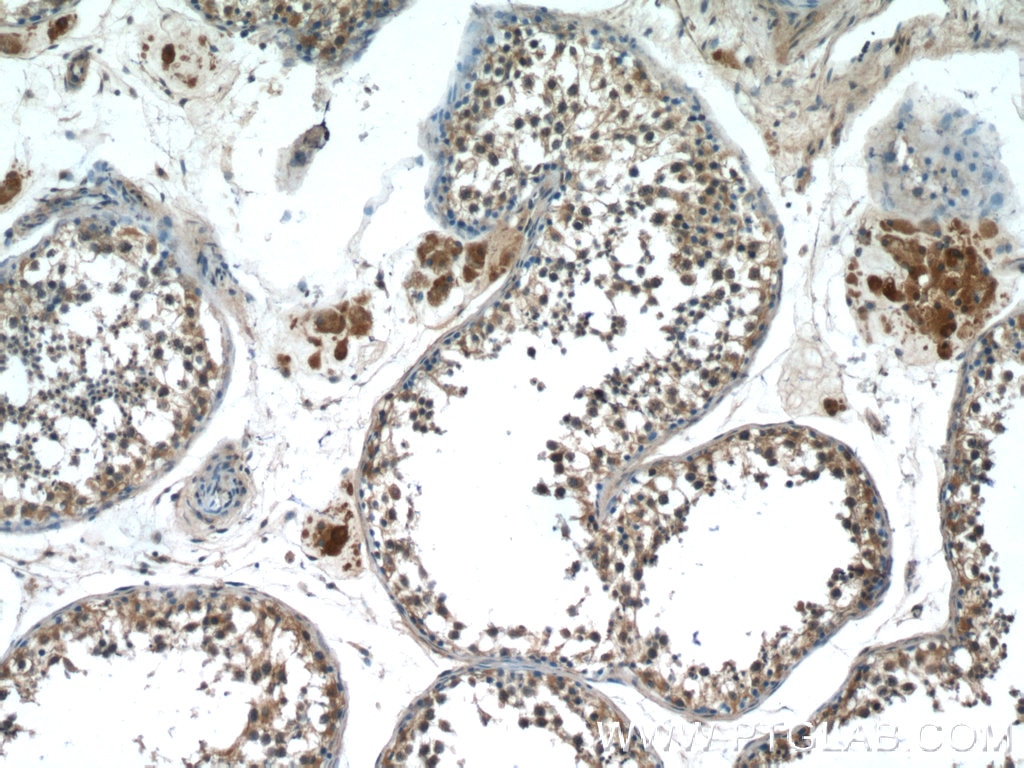 Immunohistochemistry (IHC) staining of human testis tissue using HSFY1 Polyclonal antibody (11970-1-AP)