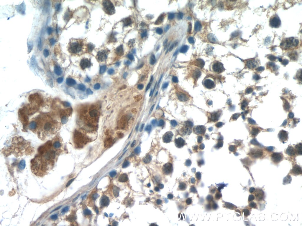 Immunohistochemistry (IHC) staining of human testis tissue using HSFY1 Polyclonal antibody (11970-1-AP)