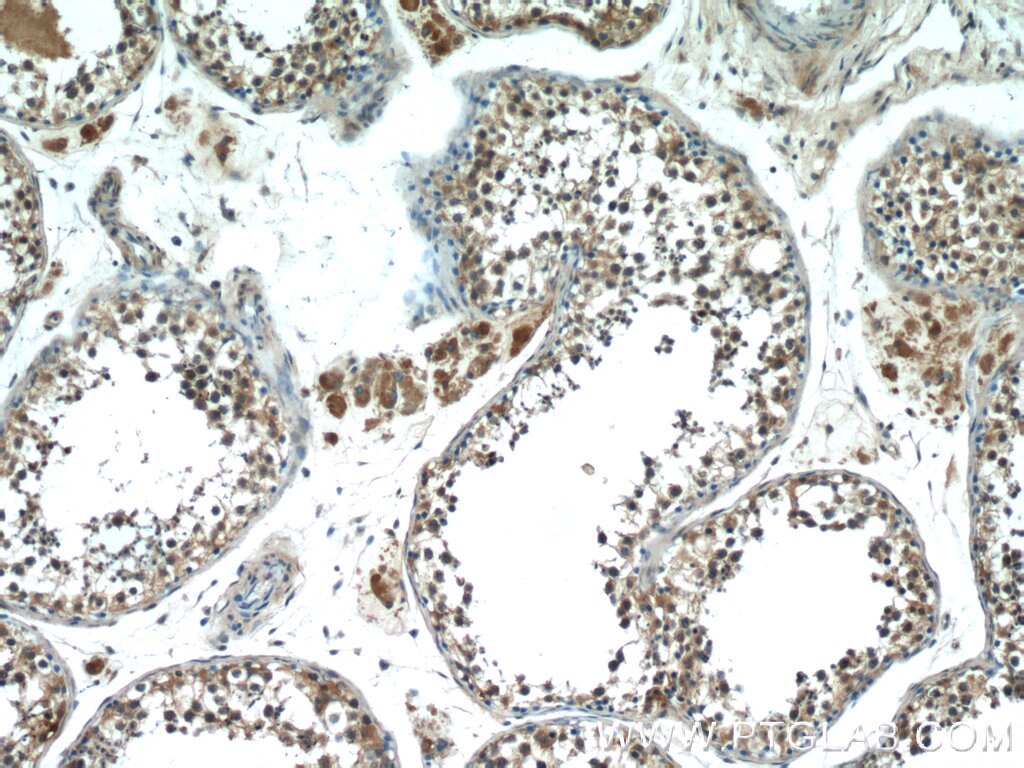 IHC staining of human testis using 11970-1-AP