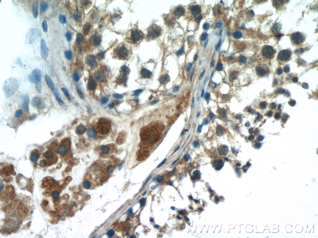 Immunohistochemistry (IHC) staining of human testis tissue using HSFY1 Polyclonal antibody (11970-1-AP)