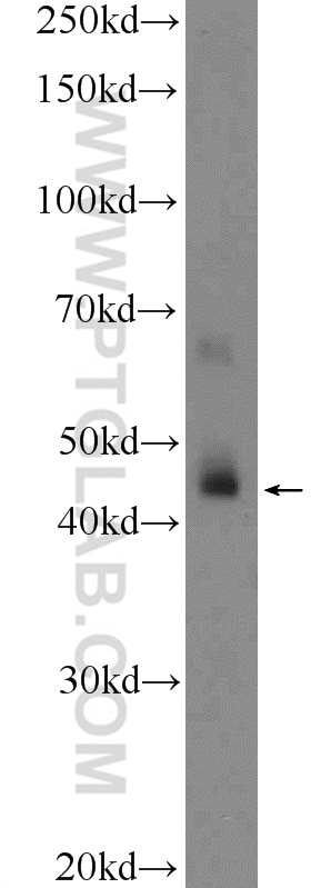 WB analysis of human testis using 11970-1-AP