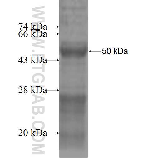 HSFY1 fusion protein Ag2592 SDS-PAGE