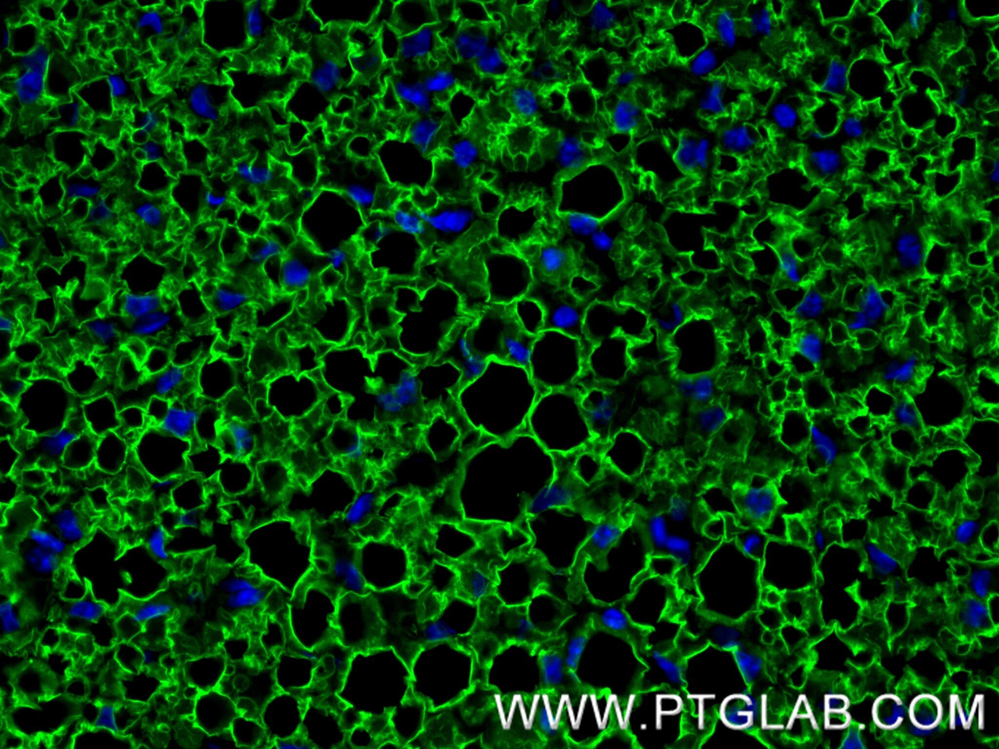 Immunofluorescence (IF) / fluorescent staining of mouse brown adipose tissue using HSL Recombinant antibody (84540-1-RR)