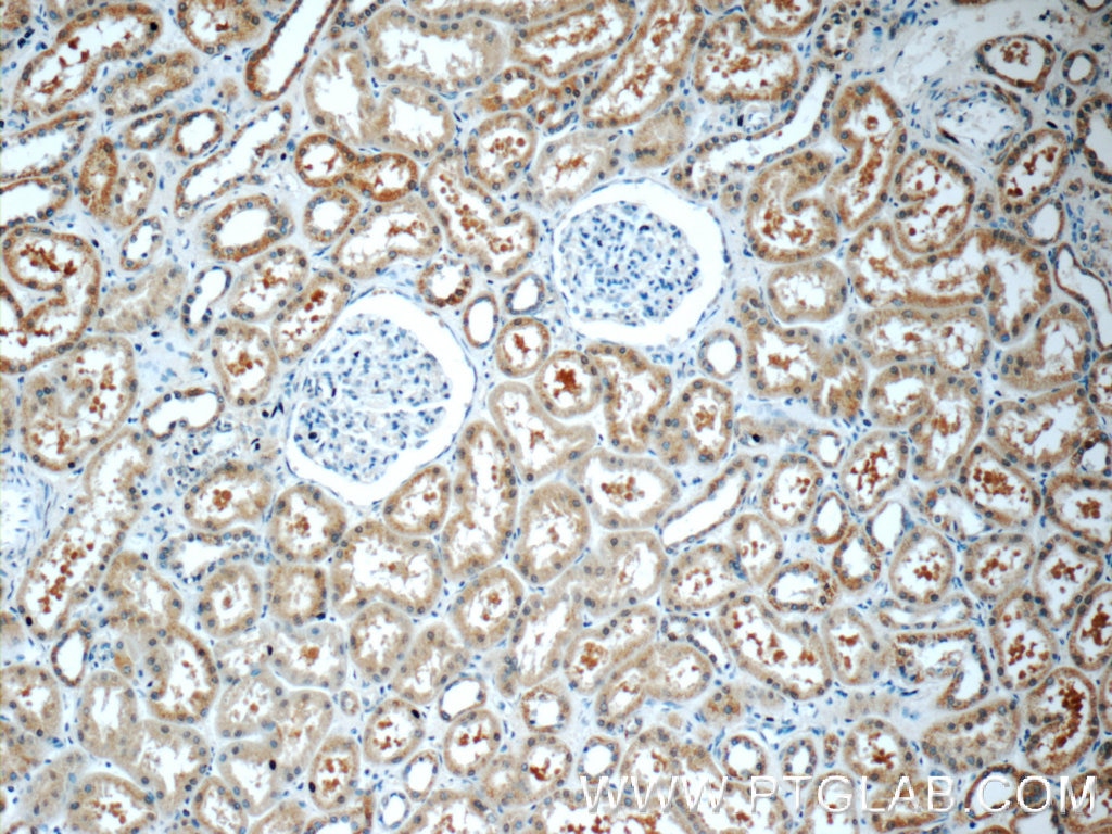 Immunohistochemistry (IHC) staining of human kidney tissue using HSN2 Polyclonal antibody (24055-1-AP)