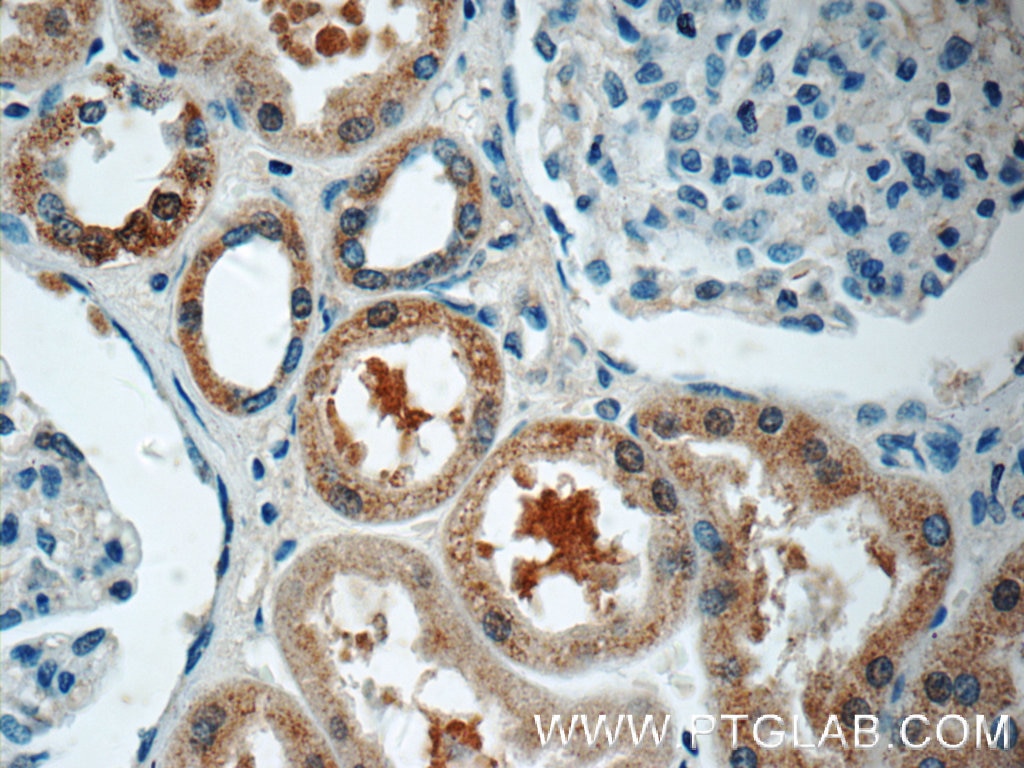 Immunohistochemistry (IHC) staining of human kidney tissue using HSN2 Polyclonal antibody (24055-1-AP)