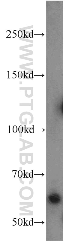 Western Blot (WB) analysis of MCF-7 cells using HSN2 Polyclonal antibody (24055-1-AP)