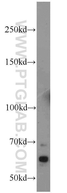 Western Blot (WB) analysis of mouse brain tissue using HSN2 Polyclonal antibody (24055-1-AP)