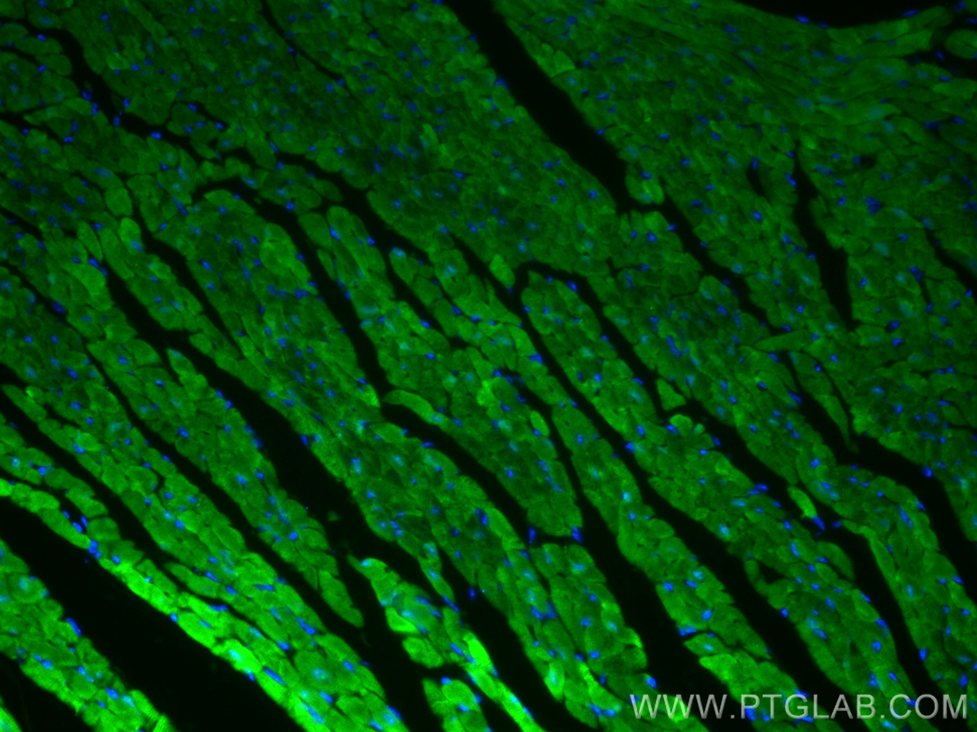 IF Staining of mouse heart using 67327-1-Ig