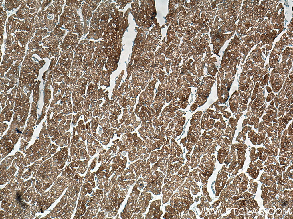 Immunohistochemistry (IHC) staining of human heart tissue using HSP20 Monoclonal antibody (67327-1-Ig)