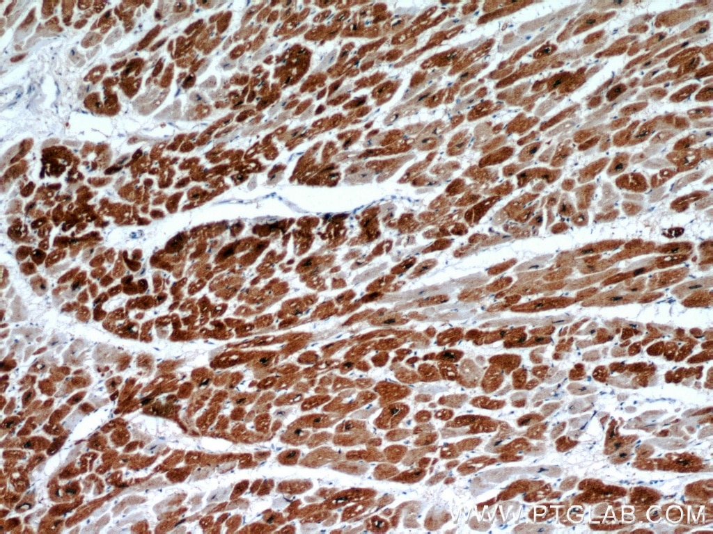 Immunohistochemistry (IHC) staining of human heart tissue using HSPB2 Polyclonal antibody (21755-1-AP)