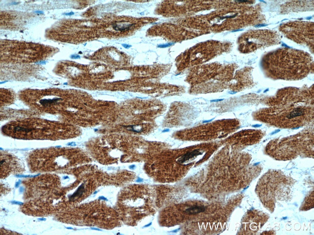 Immunohistochemistry (IHC) staining of human heart tissue using HSPB2 Polyclonal antibody (21755-1-AP)