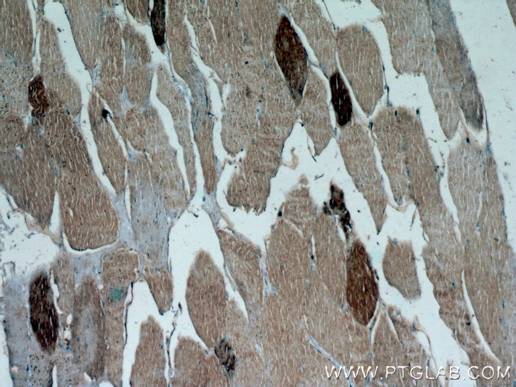 Immunohistochemistry (IHC) staining of human skeletal muscle tissue using HSPB2 Polyclonal antibody (21755-1-AP)