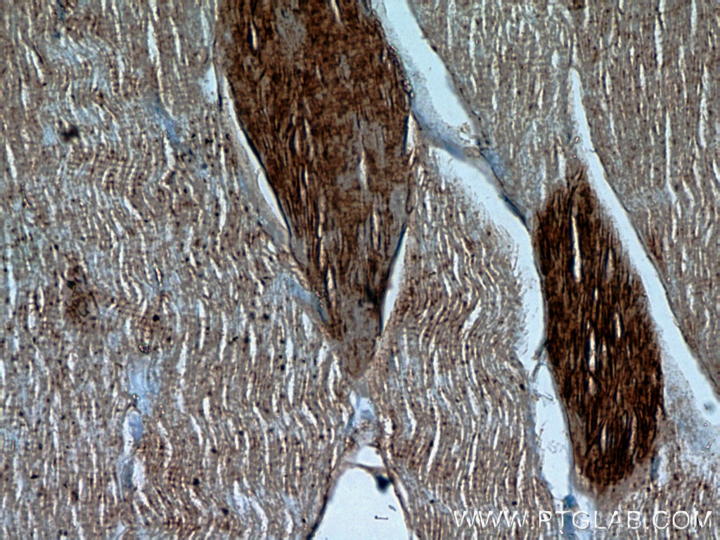 Immunohistochemistry (IHC) staining of human skeletal muscle tissue using HSPB2 Polyclonal antibody (21755-1-AP)