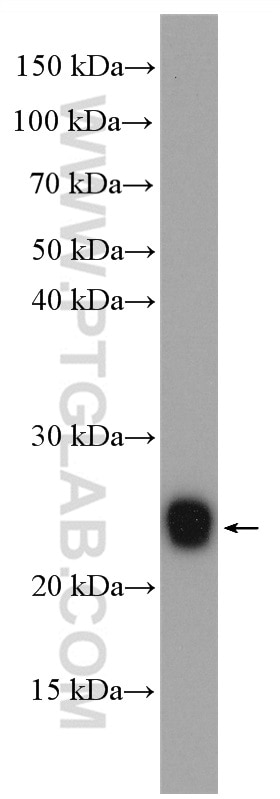 Western Blot (WB) analysis of human skeletal muscle tissue using HSPB2 Polyclonal antibody (21755-1-AP)