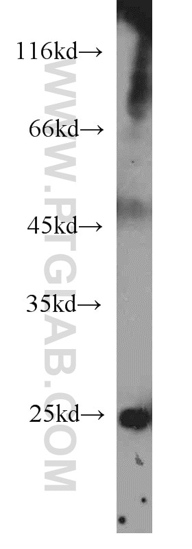 WB analysis of human skeletal muscle using 21755-1-AP