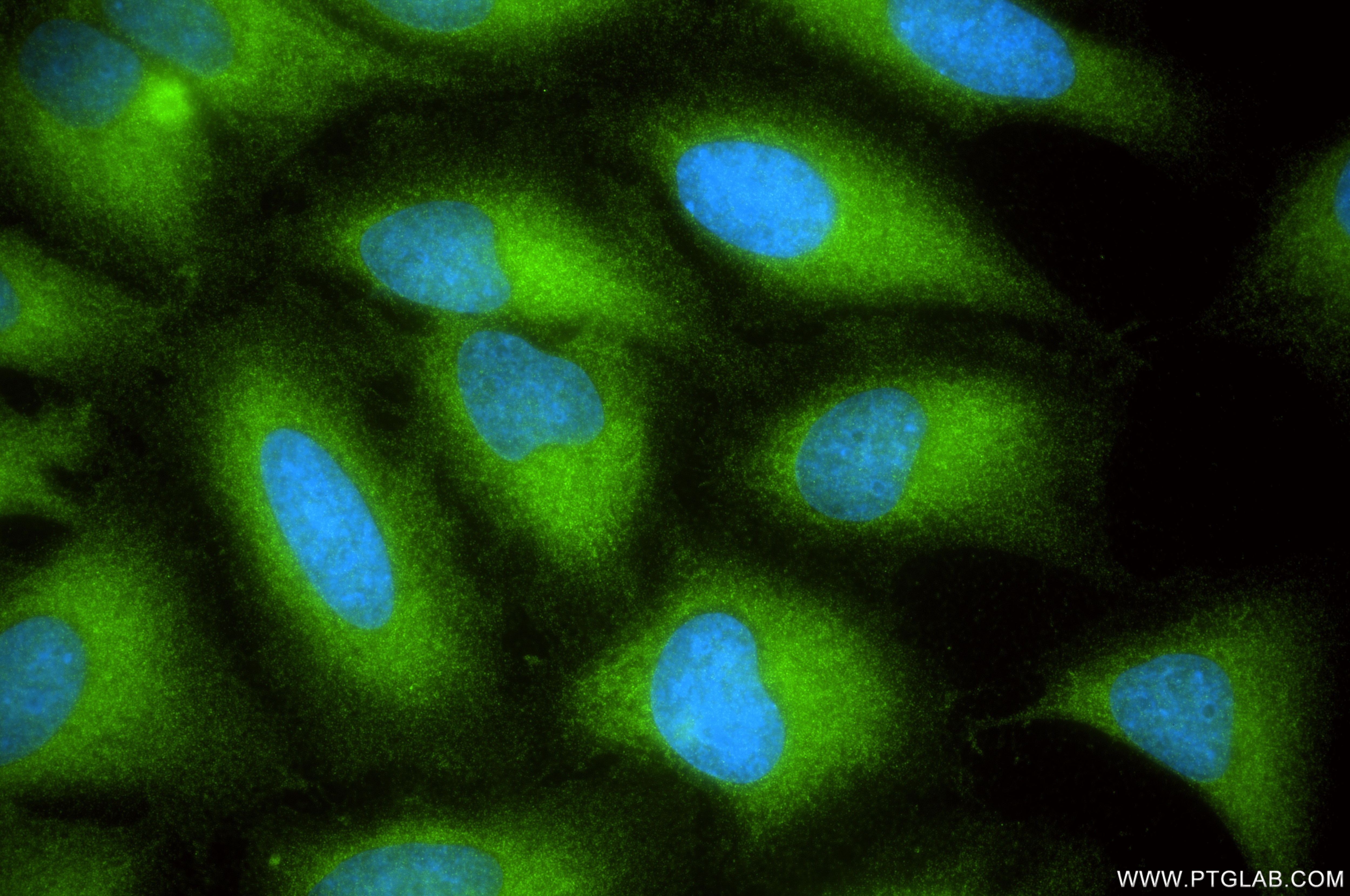 Immunofluorescence (IF) / fluorescent staining of HeLa cells using HSP27 Recombinant monoclonal antibody (80046-5-RR)