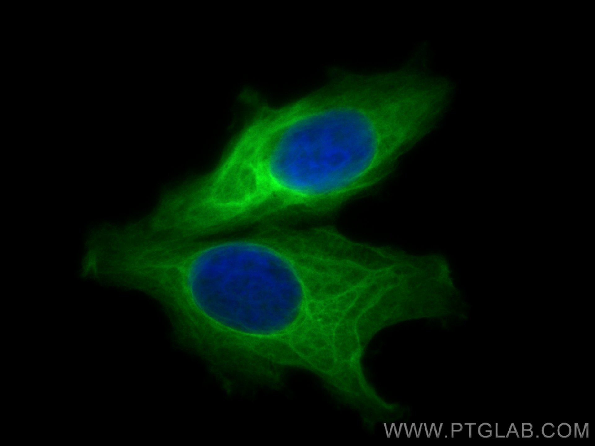 Immunofluorescence (IF) / fluorescent staining of MCF-7 cells using CoraLite® Plus 488-conjugated HSP27 Monoclonal ant (CL488-66767)