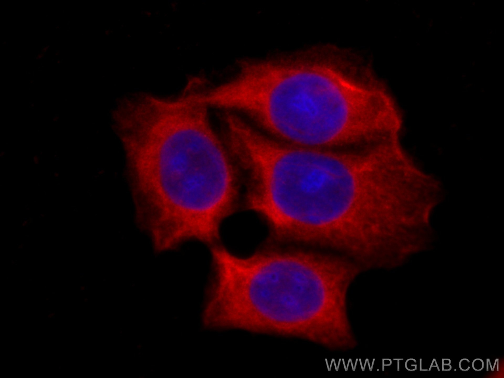 IF Staining of MCF-7 using CL594-66767