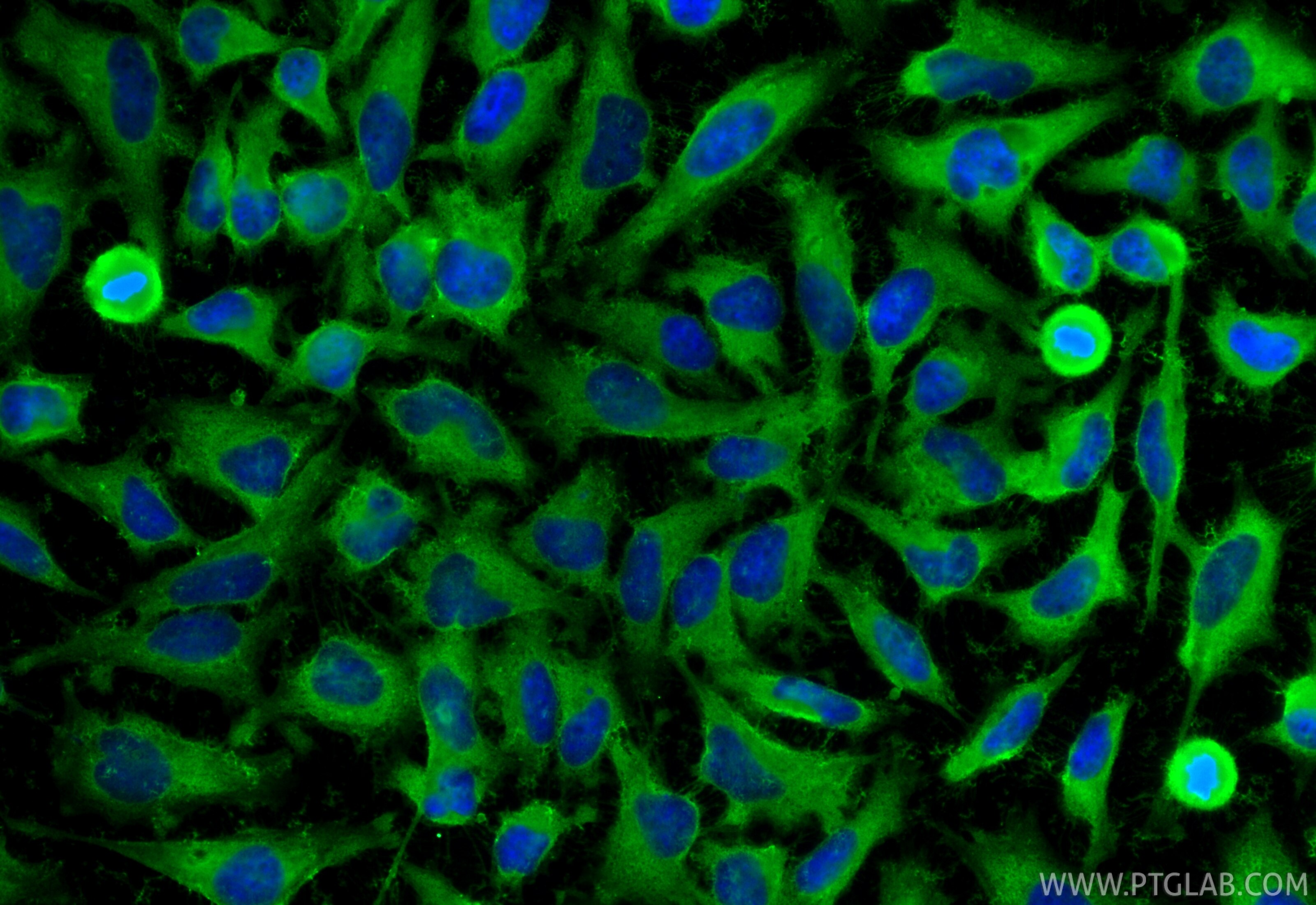 IF Staining of HeLa using RMX00089 Immunofluorescence (IF) / fluorescent staining of HeLa cells using Multi-rAb® HSP27 Multi-Recombinant antibody (RMX00089)
