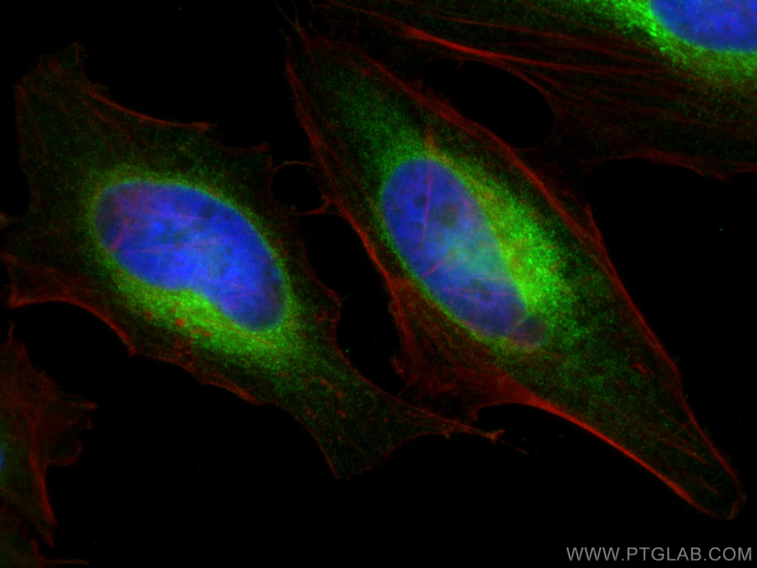 Immunofluorescence (IF) / fluorescent staining of HeLa cells using HSP47 Monoclonal antibody (67863-1-Ig)