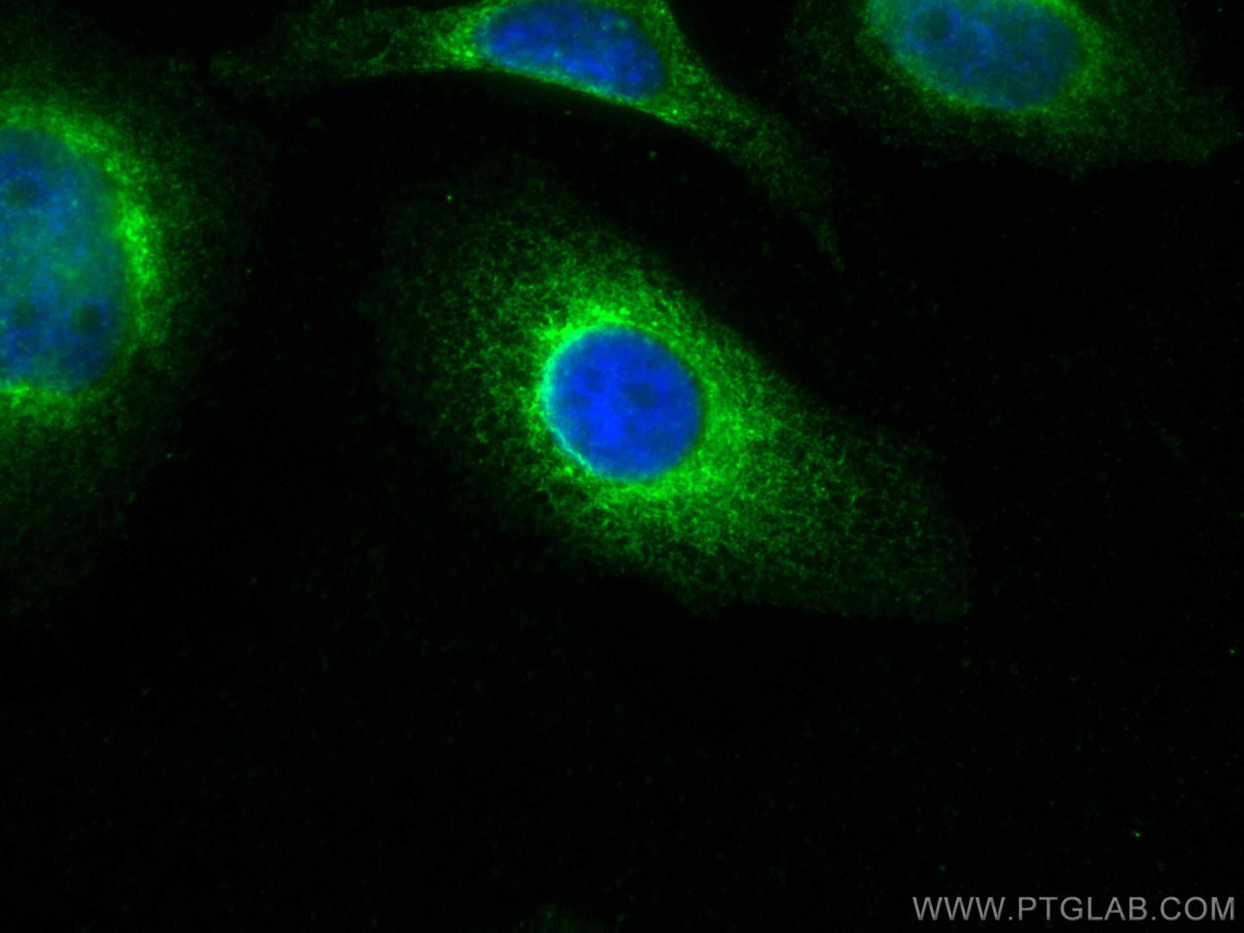 Immunofluorescence (IF) / fluorescent staining of HepG2 cells using HSP47/SERPINH1 Monoclonal antibody (67863-1-Ig)