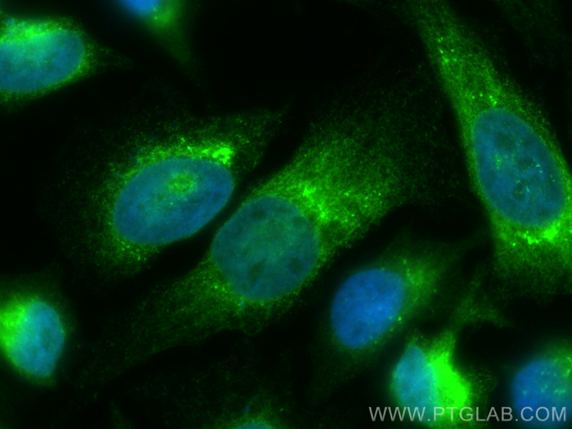 IF Staining of HeLa using CL488-67863