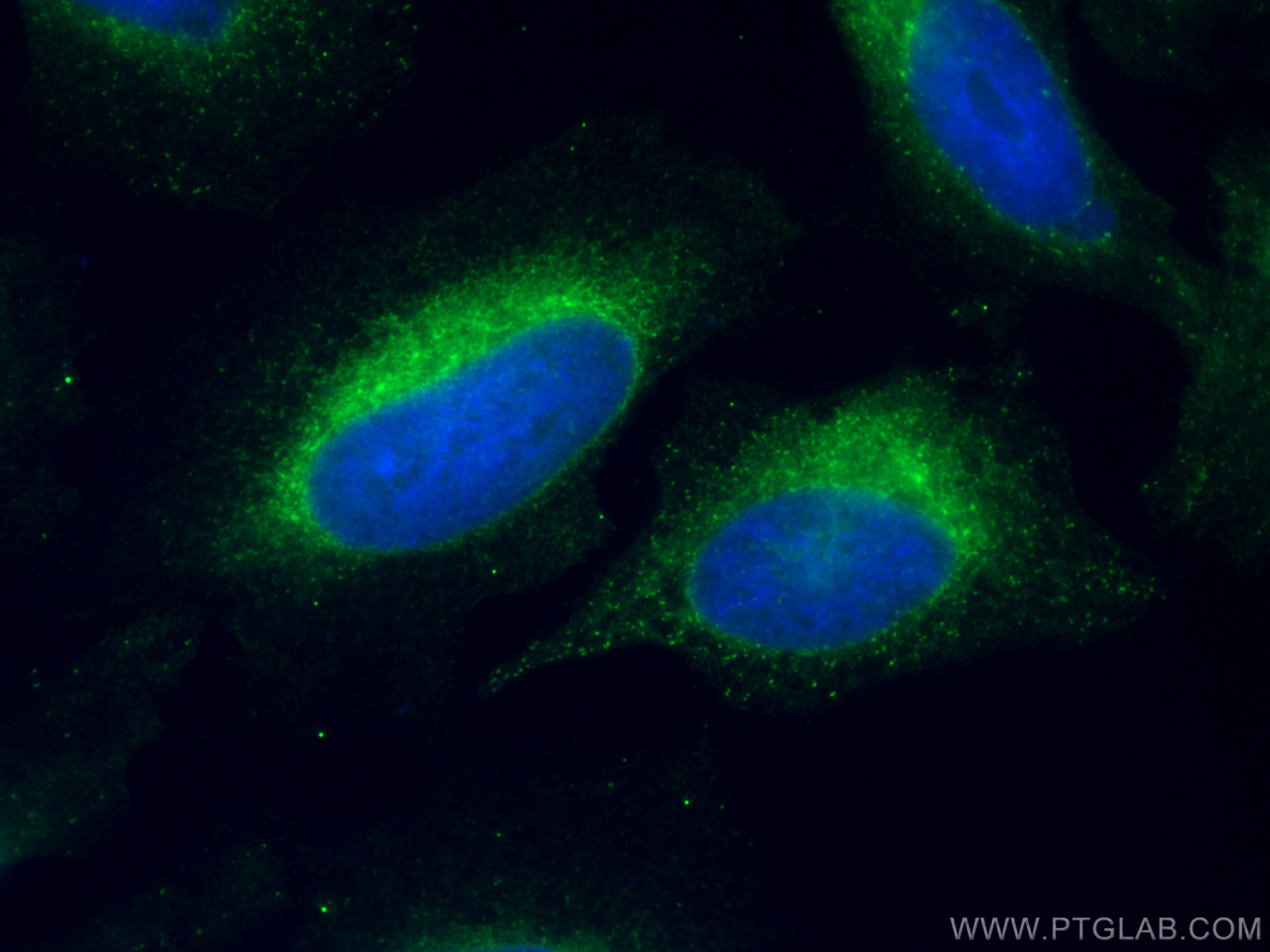 IF Staining of HeLa using CL488-67863