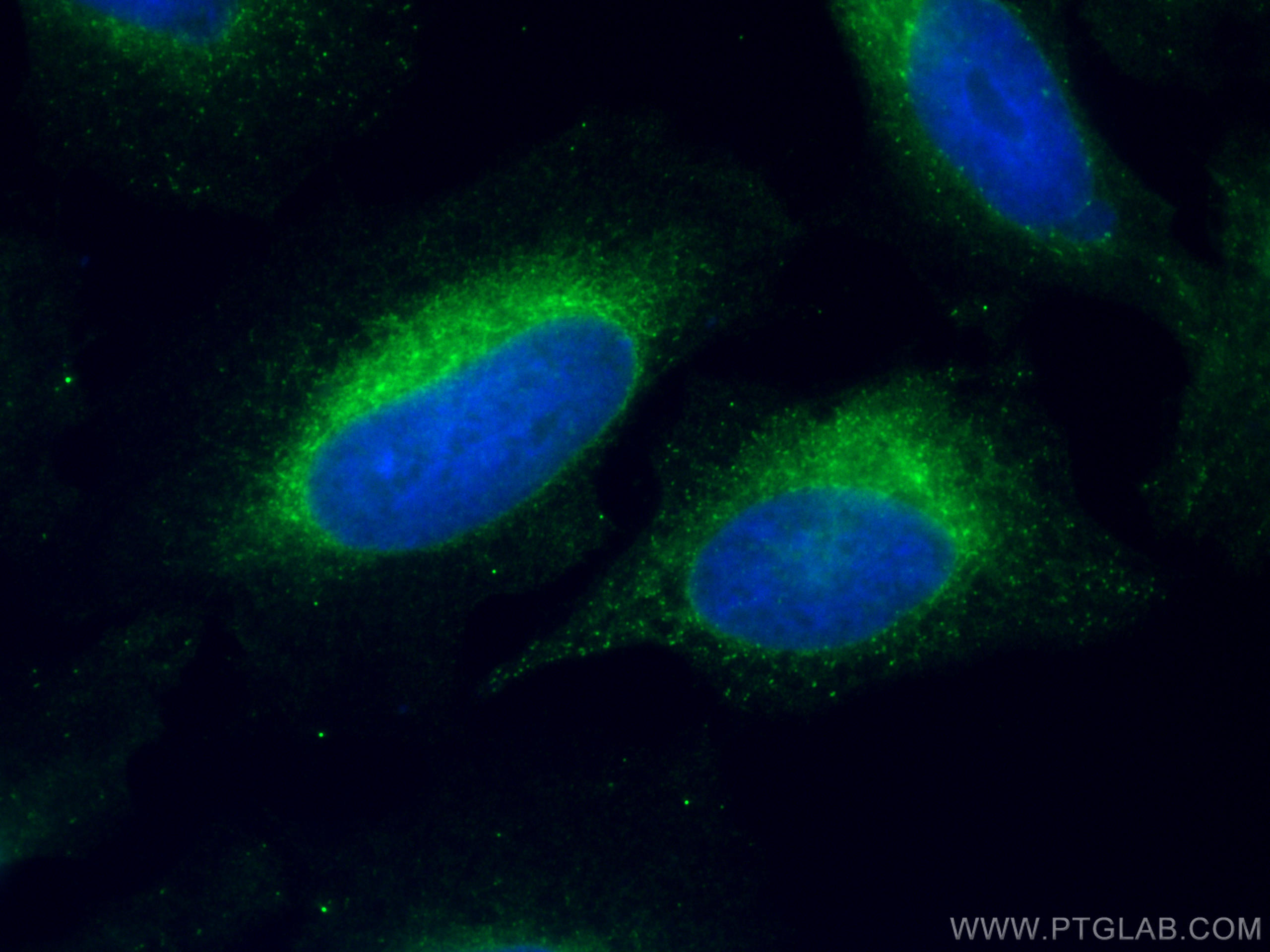 Immunofluorescence (IF) / fluorescent staining of HeLa cells using CoraLite® Plus 488-conjugated HSP47 Monoclonal ant (CL488-67863)