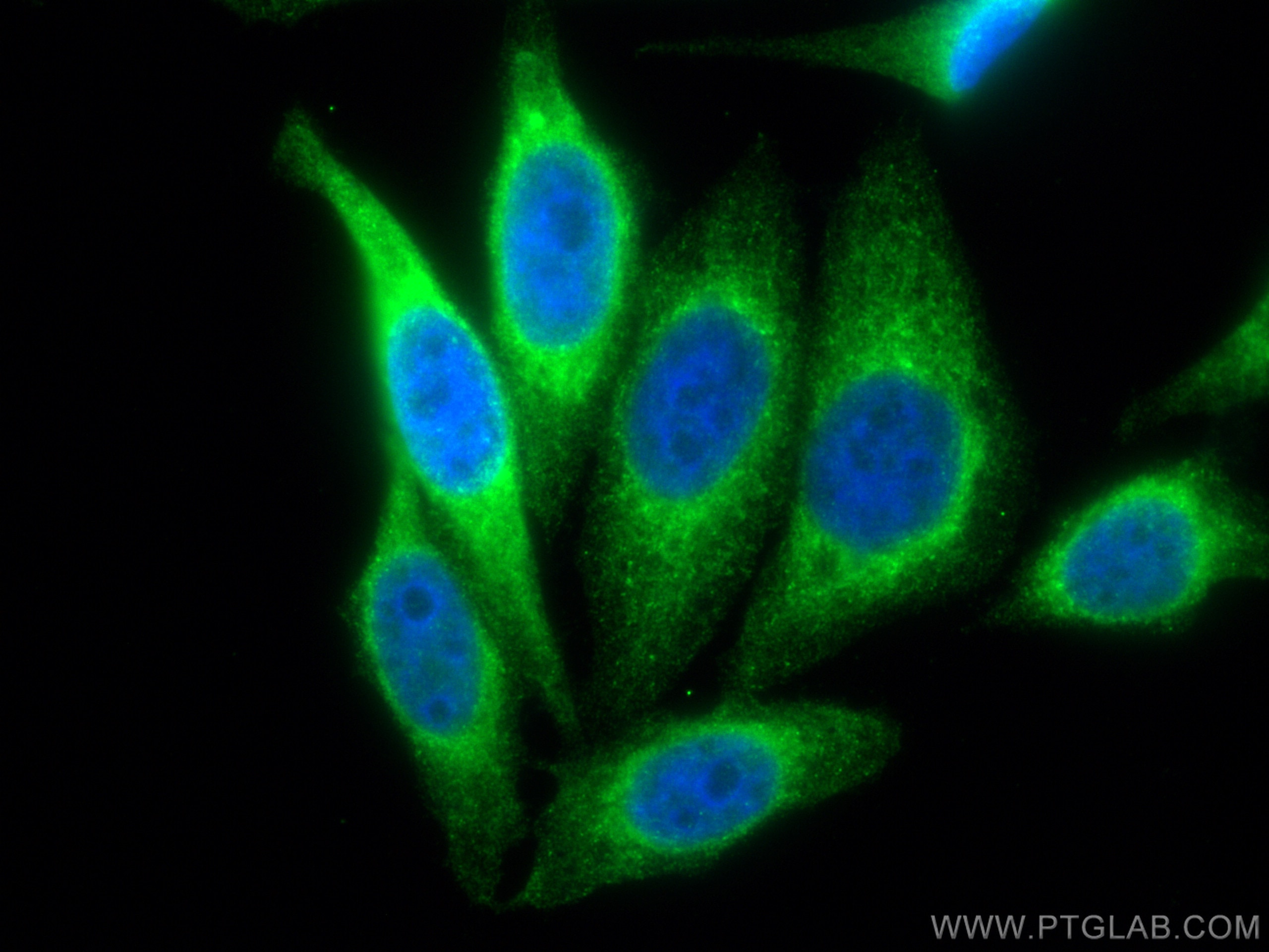 IF Staining of HepG2 using CL488-67863