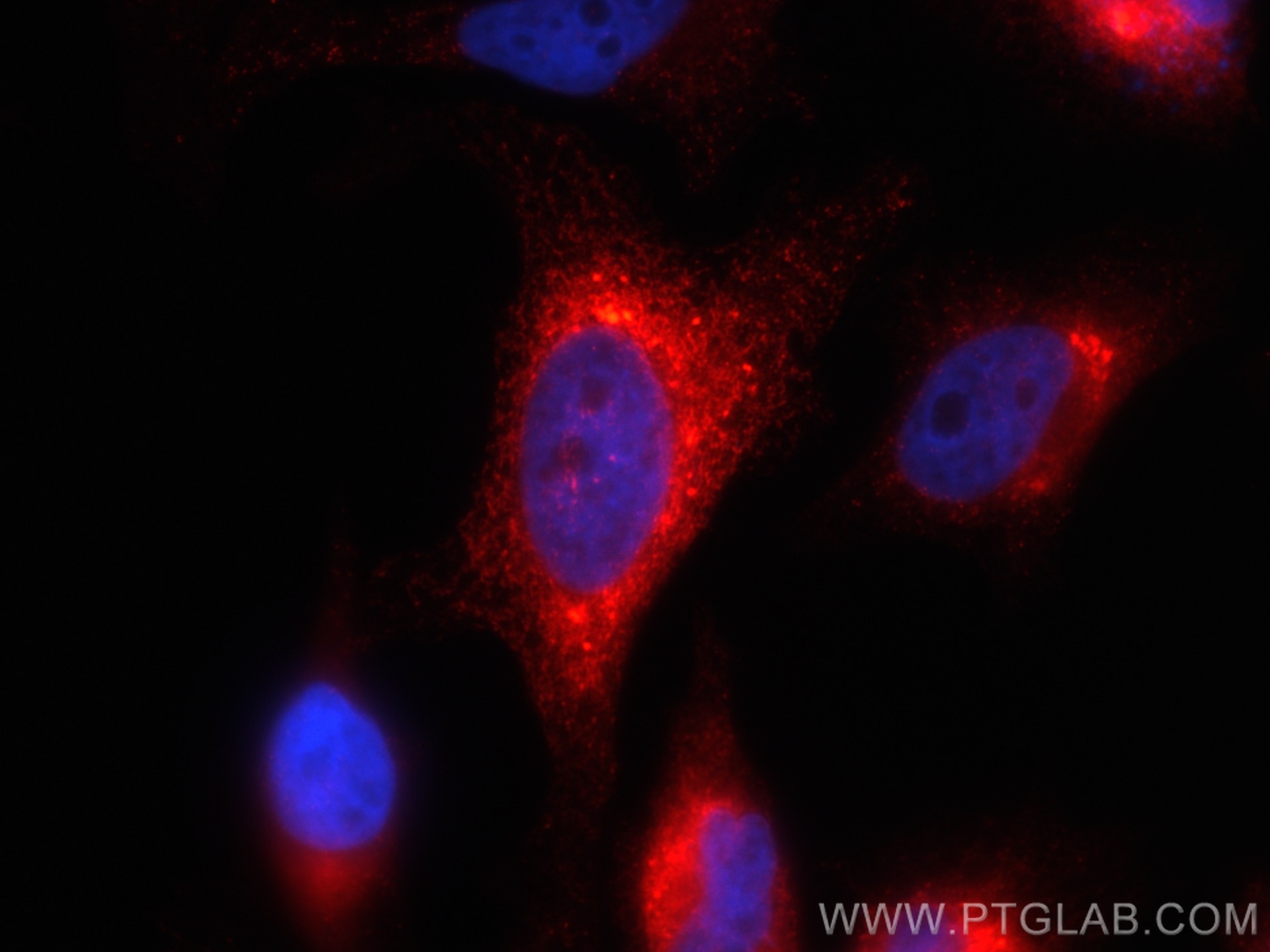 Immunofluorescence (IF) / fluorescent staining of HeLa cells using CoraLite®594-conjugated HSP47 Monoclonal antibody (CL594-67863)