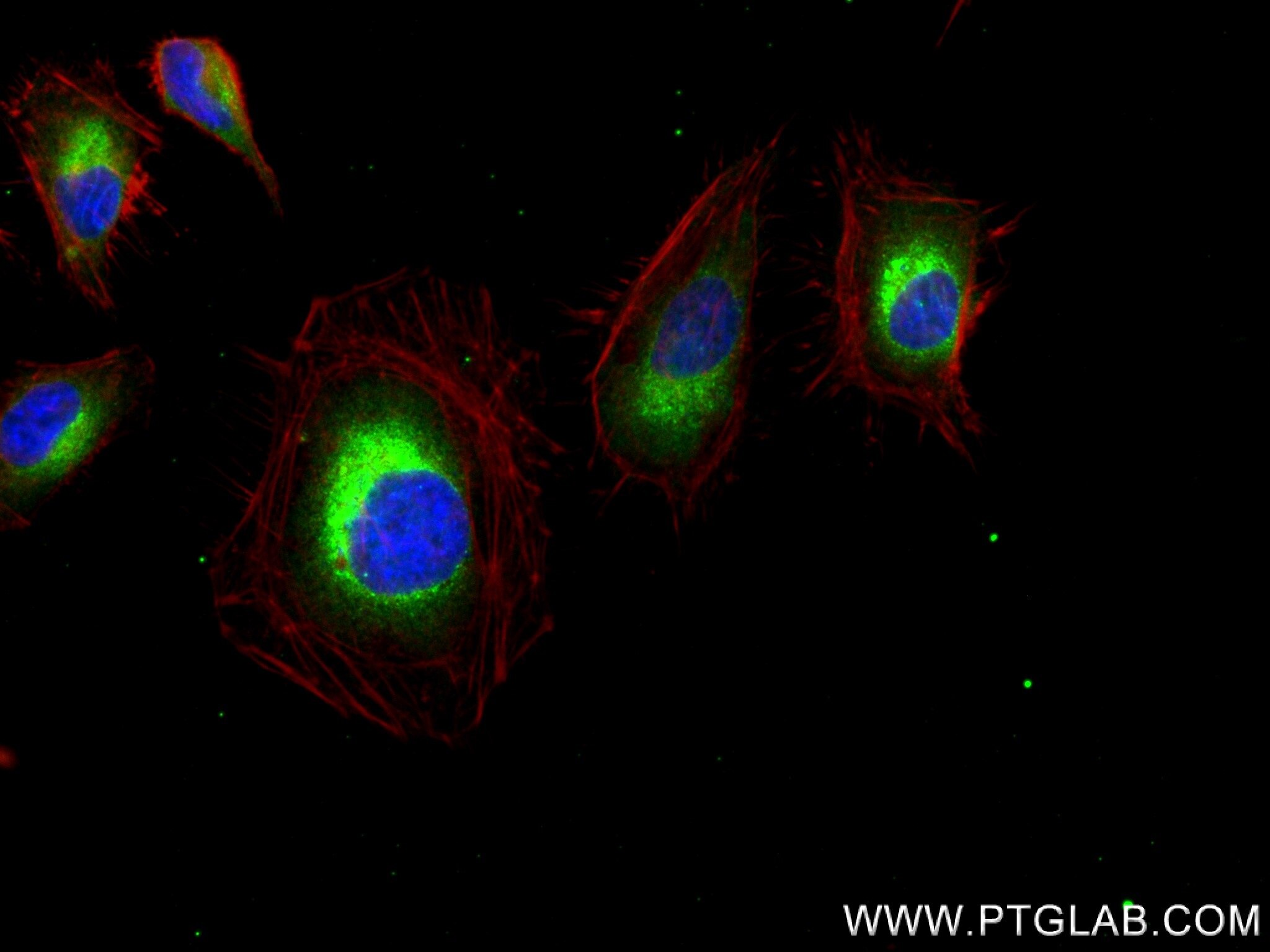 Immunofluorescence (IF) / fluorescent staining of HeLa cells using HSP47/SERPINH1 Recombinant antibody (83689-4-RR)