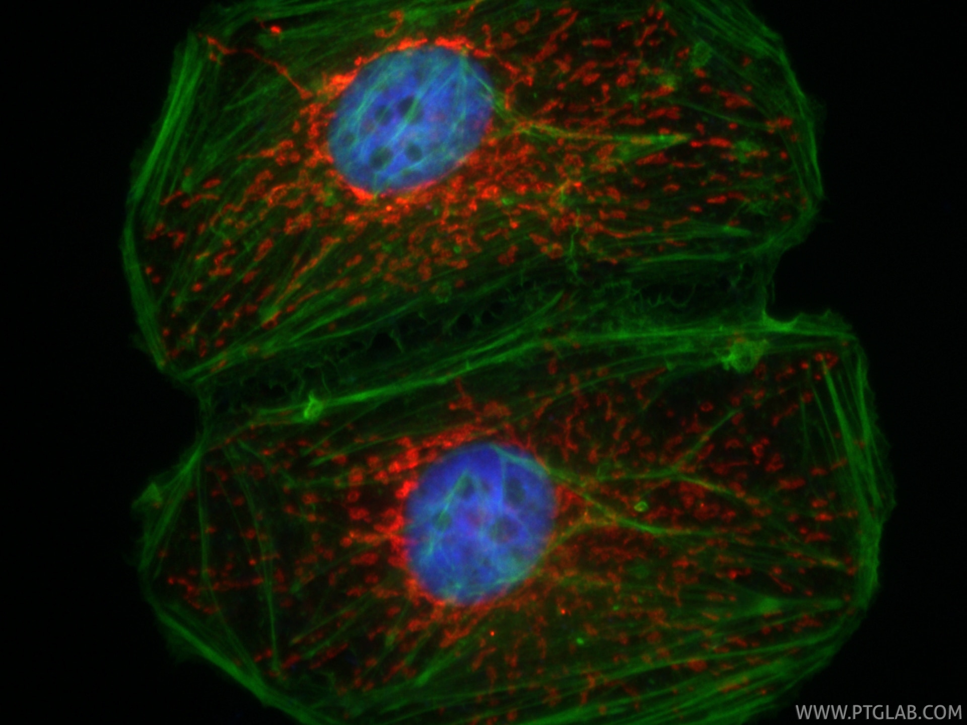 Immunofluorescent analysis of (4% PFA) fixed HeLa cells using CoraLite®594 HSP60 antibody (CL594-86275, Clone: 250248D1 ) at dilution of 1:200, CL488-phalloidin (green). Immunofluorescence (IF) / fluorescent staining of HeLa cells using CoraLite®594-conjugated HSP60 Recombinant monoclon (CL594-86275)