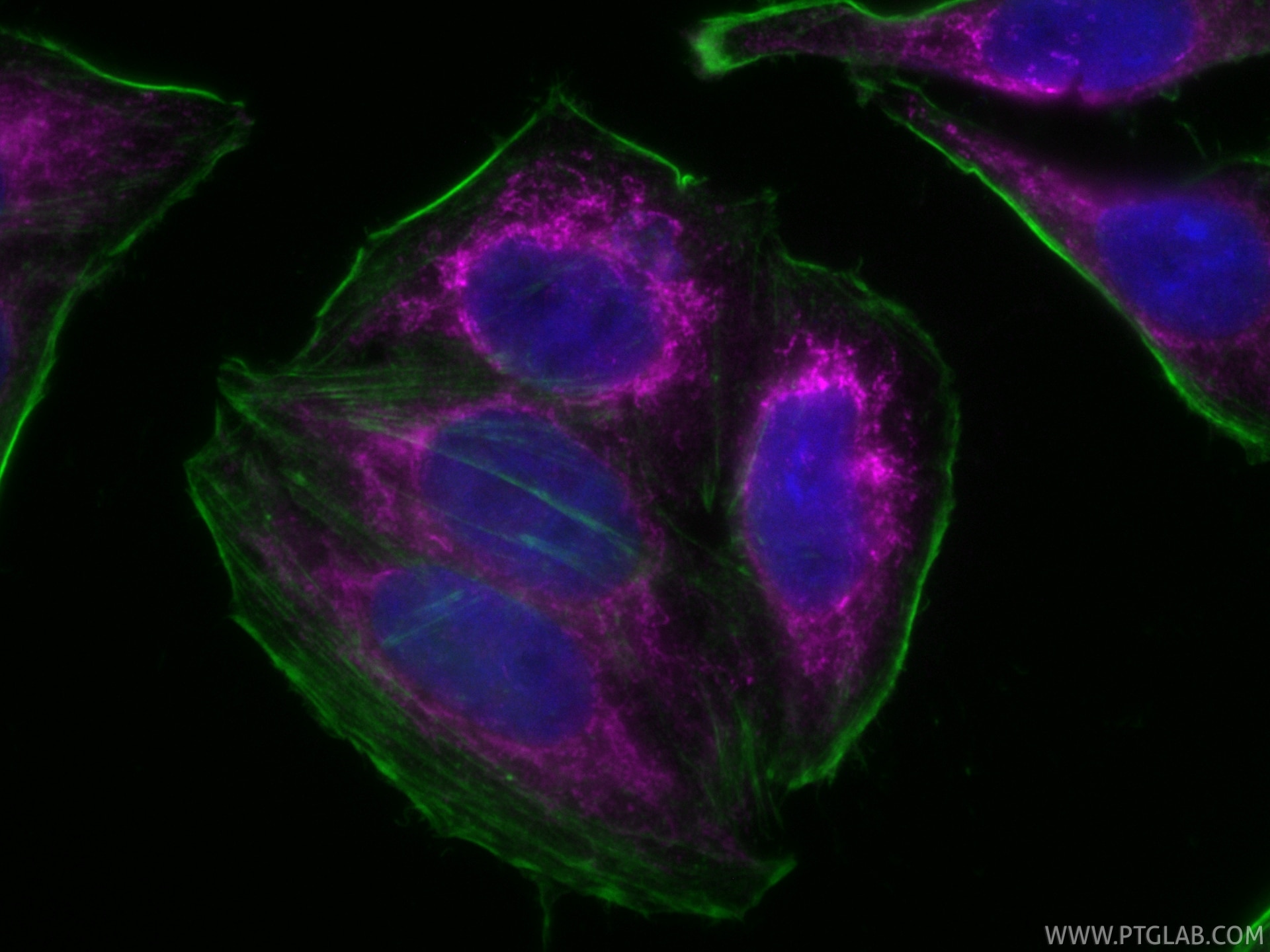 Immunofluorescent analysis of (4% PFA) fixed HepG2 cells using CoraLite® Plus 647 HSP60 antibody (CL647-86275, Clone: 250248D1 ) at dilution of 1:200, CL488-phalloidin (green). Immunofluorescence (IF) / fluorescent staining of HepG2 cells using CoraLite® Plus 647-conjugated HSP60 Recombinant mo (CL647-86275)