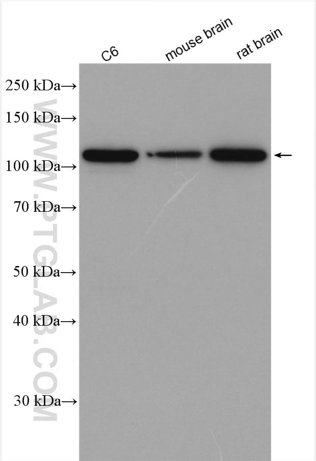 Western Blot (WB) analysis of various lysates using HSPA4 Polyclonal antibody (21206-1-AP)