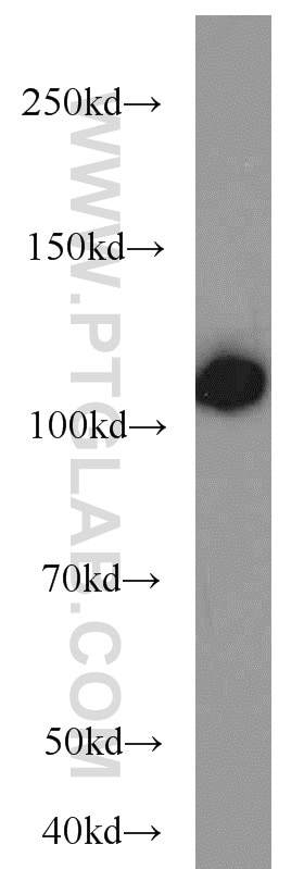 Western Blot (WB) analysis of mouse testis tissue using HSPA4 Polyclonal antibody (21206-1-AP)