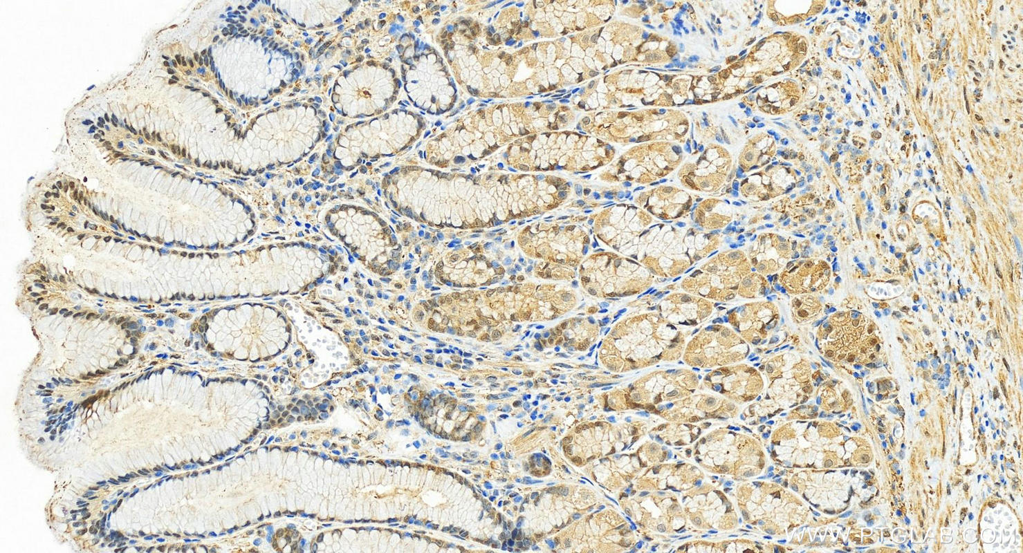 Immunohistochemistry (IHC) staining of human stomach tissue using HSPA1B Polyclonal antibody (25405-1-AP)