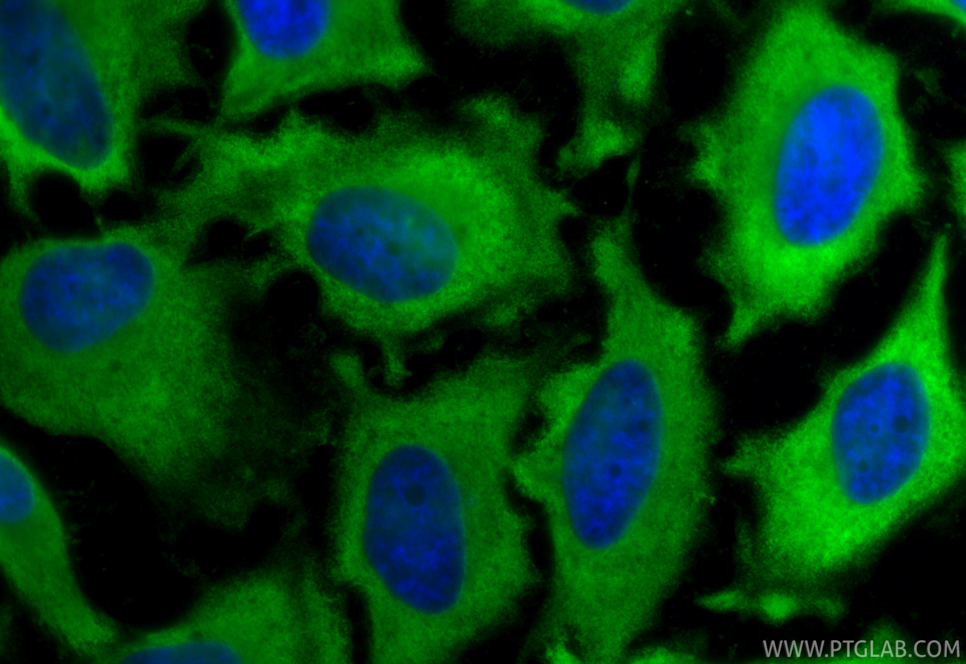 IF Staining of HeLa using 25405-1-AP Immunofluorescence (IF) / fluorescent staining of HeLa cells using HSPA1B Polyclonal antibody (25405-1-AP)