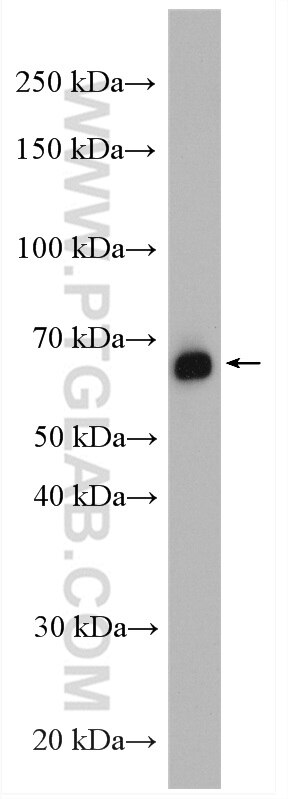 HSPA1B