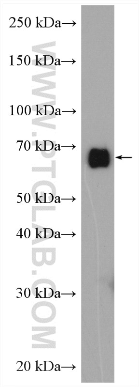 Western Blot (WB) analysis of rat brain tissue using HSP70 Polyclonal antibody (25405-1-AP)