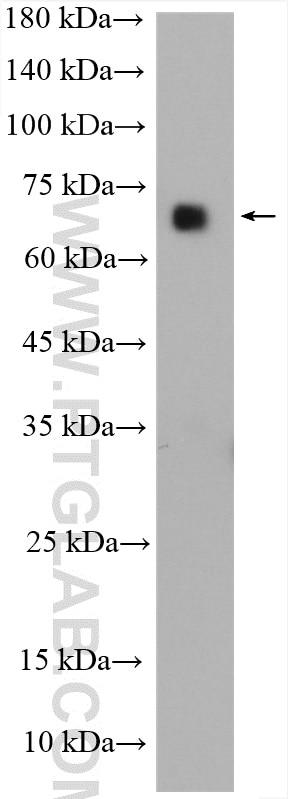 Western Blot (WB) analysis of mouse brain tissue using HSP70 Polyclonal antibody (25405-1-AP)