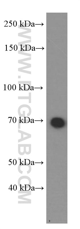Western Blot (WB) analysis of HeLa cells using HSP70 Monoclonal antibody (66183-1-Ig)
