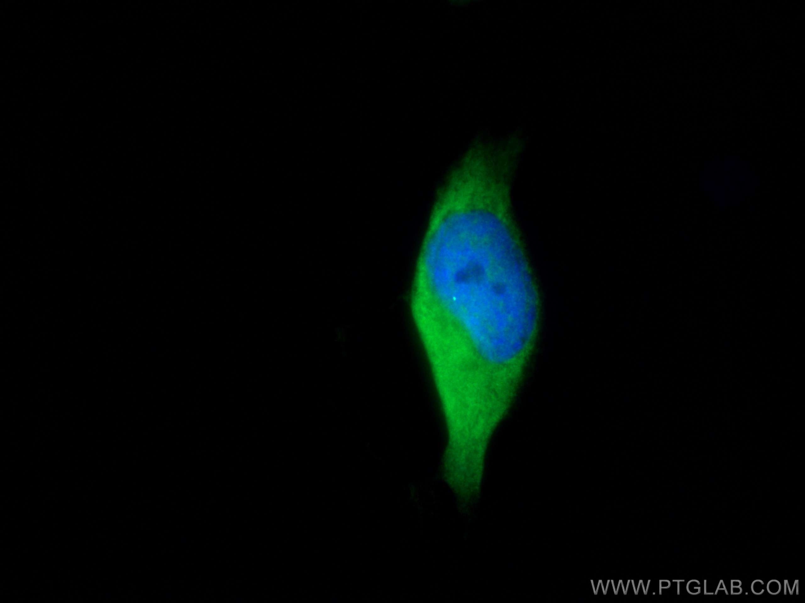 Immunofluorescence (IF) / fluorescent staining of HeLa cells using HSP70 Recombinant antibody (80735-1-RR)