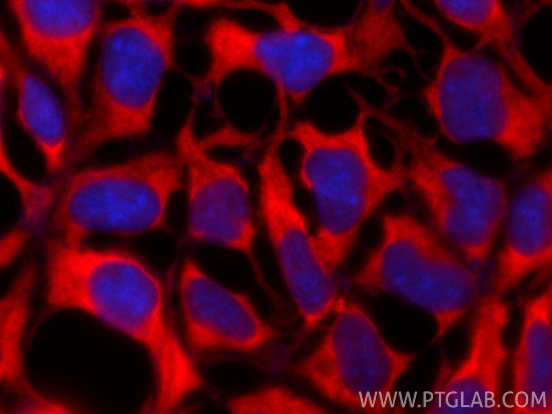 Immunofluorescence (IF) / fluorescent staining of HEK-293 cells using CoraLite®594-conjugated HSP70 Polyclonal antibody (CL594-10995)