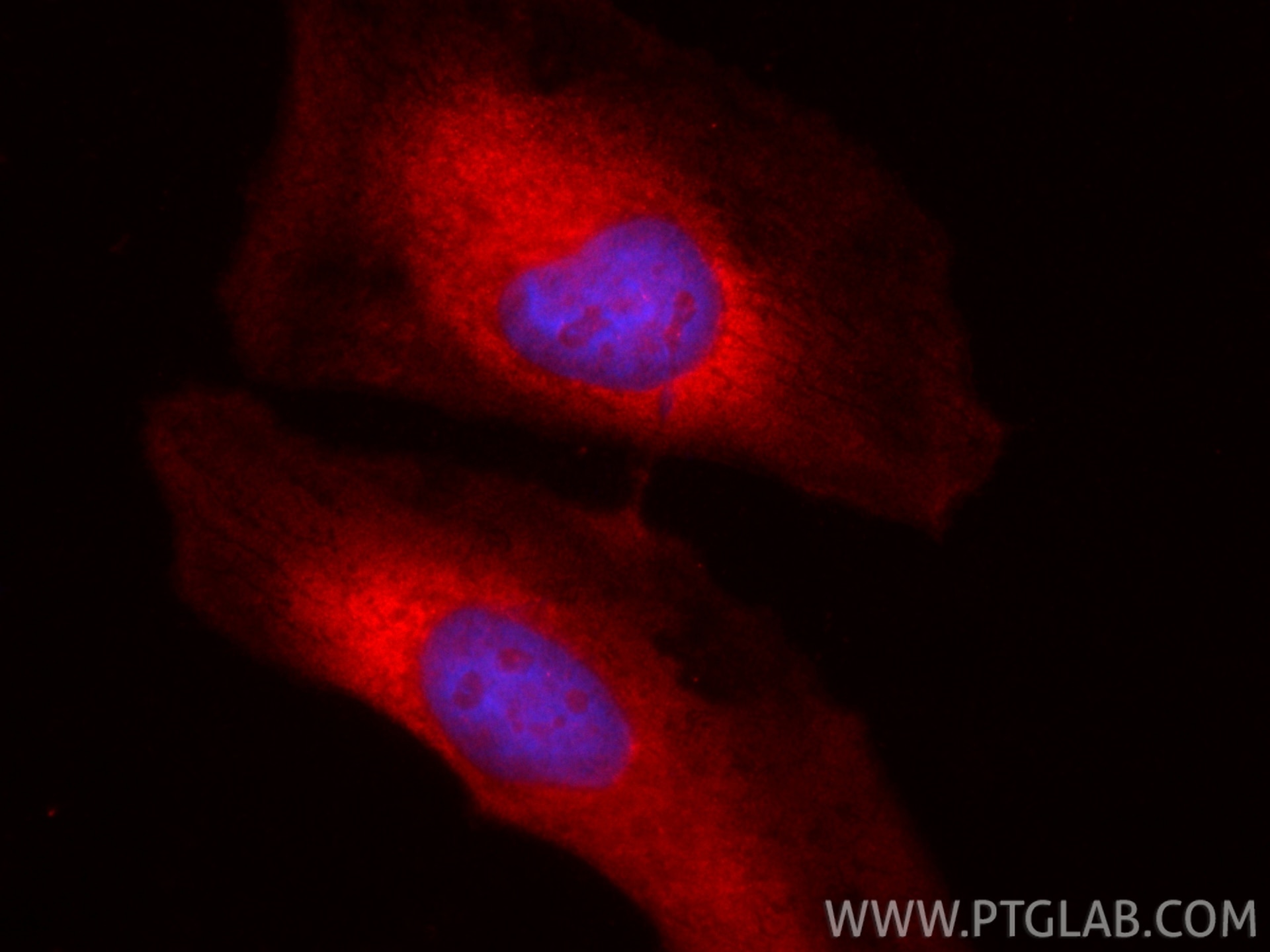 Immunofluorescence (IF) / fluorescent staining of HeLa cells using CoraLite®594-conjugated HSP70 Polyclonal antibody (CL594-10995)