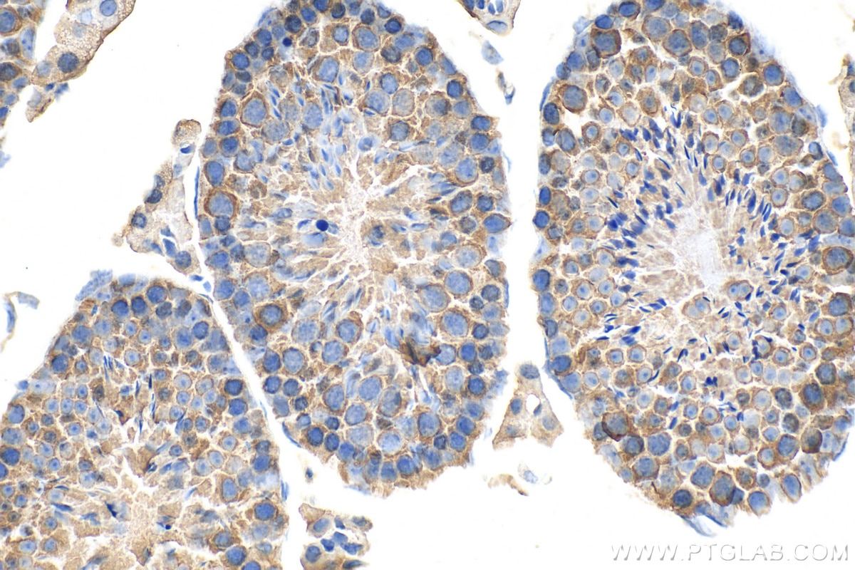 Immunohistochemistry (IHC) staining of mouse testis tissue using HSP90 Polyclonal antibody (13171-1-AP)