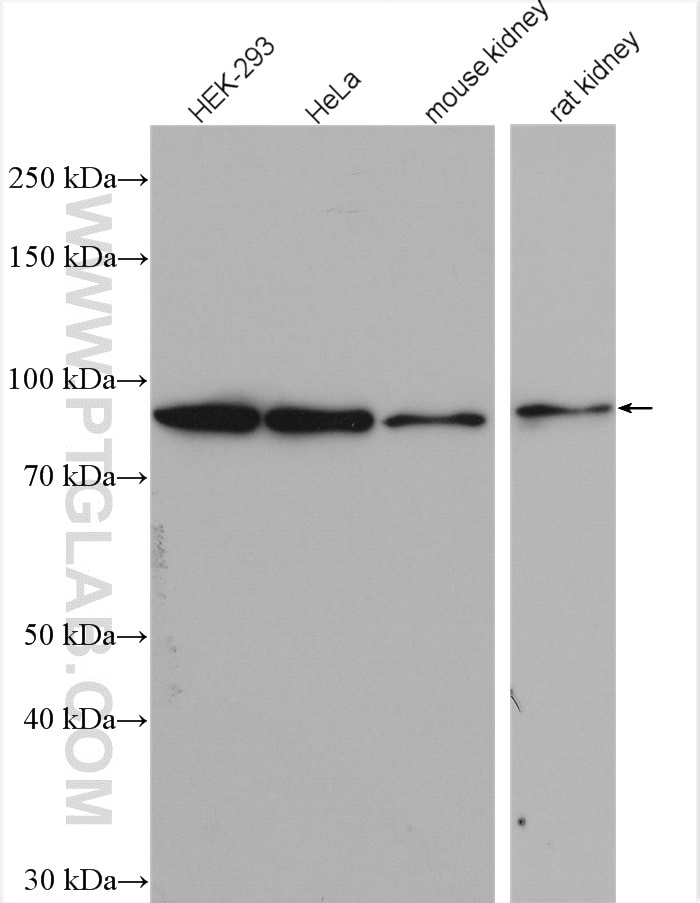 Western Blot (WB) analysis of various lysates using HSP90 Polyclonal antibody (13171-1-AP)