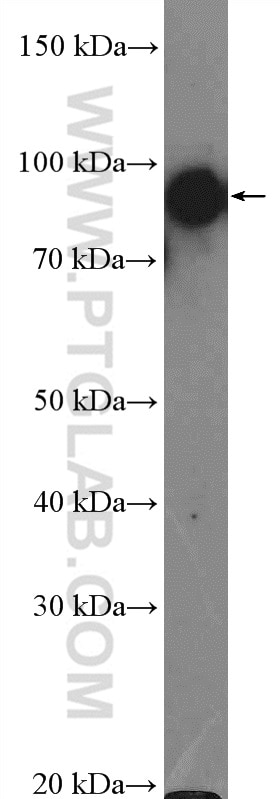 HSP90 Polyclonal antibody