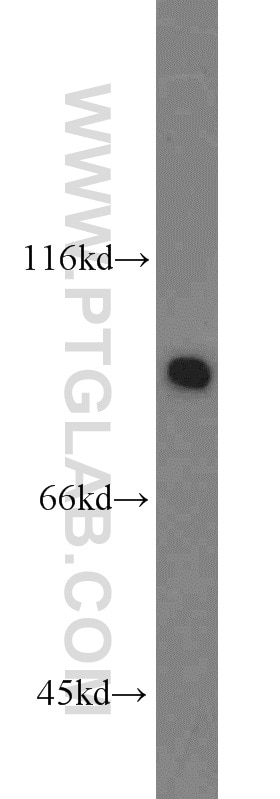 HSP90 Polyclonal antibody